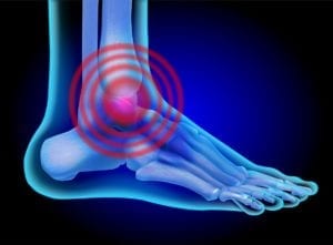 treat arthritis foot pain in Solebury Pennsylvania