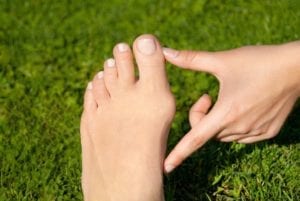 treat bunions at a podiatrist in Holland Pennsylvania